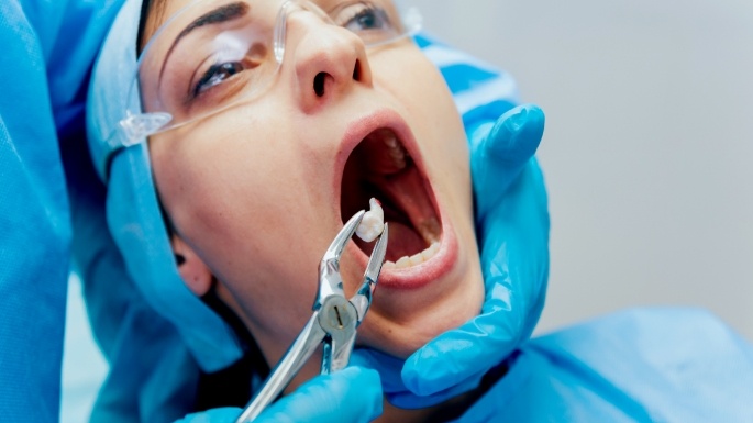 Dentist performing wisdom tooth extraction